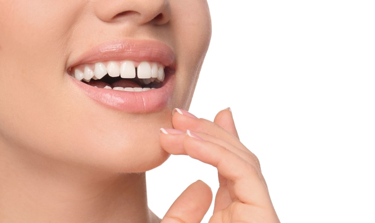 Fechamentos de Diastemas e Harmonização Estética